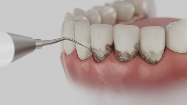 Reliable Dental contractor in Maplewood, MN by Smile Center Dentistry